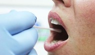 Điền kinh thế giới công bố triển khai xét nghiệm gen